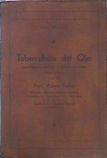 Tuberculosis Del Ojo Especialmente Del Iris Y Del Cuerpo Ciliar | 47674 | Fihalho Abreu Prof.