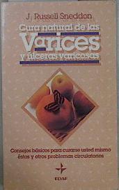 Cura natural de las varices y úlceras varicosas | 148224 | Sneddon, J. Russell