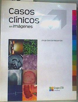 Casos Clínicos en Imágenes | 161157 | García Macarrón, Jorge