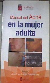 Acné en la mujer adulta : handbook dermatología | 177473 | José Luis López Estebaranz