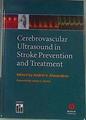 Cerebrovascular Ultrasound in Stroke Prevention and Treatment | 164548 | Alexandrov, Andrei V/Edited by