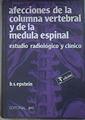 Afecciones de la columna vertebral y de la médula espinal | 172347 | Epstein, Bernard S.