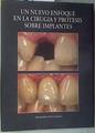 Un nuevo enfoque en la cirugía y prótesis sobre implantes | 168951 | Anitua Aldecoa, Eduardo de