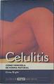 Celulitis cómo vencerla de forma natural | 122566 | Righi, Gina