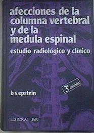 Afecciones de la columna vertebral y de la médula espinal | 172347 | Epstein, Bernard S.