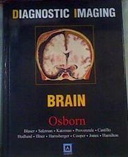 Diagnostic Imaging Brain: Top 250 Diagnostic | 164549 | Salzman, Blaser/Provenzale, Katzman/Et al ...., Castillo Hedlund