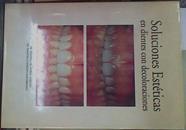 Soluciones estéticas en dientes con decoloraciones | 154607 | Anitua Aldecoa, Eduardo de/Gascón Mayordomo, Francisco
