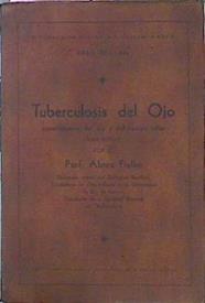 Tuberculosis Del Ojo Especialmente Del Iris Y Del Cuerpo Ciliar | 47674 | Fihalho Abreu Prof.