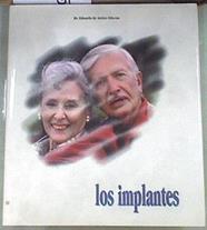 Los implantes | 169903 | Anitua Aldecoa, Eduardo de