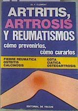 Artritis artrosis y reumatismos Cómo prevenirlos Cómo curarlos | 172820 | Clement, Francisco