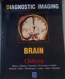 Diagnostic Imaging Brain: Top 250 Diagnostic | 164549 | Salzman, Blaser/Provenzale, Katzman/Et al ...., Castillo Hedlund